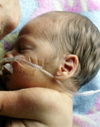 A Baby's Lungs are Able to Breath Air, However if Born Now Would Need Assistance
