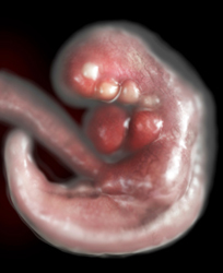 An Embryo at Approximately 4 Weeks of Gestation.