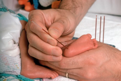 While in Hospital Your Baby will Have a Heel Prick Blood Test to Screen for Some Rare Congenital Disorders.